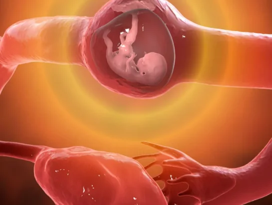 Ectopic Pregnancy
                          