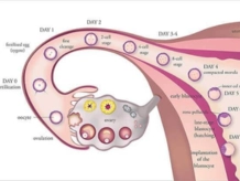 Ovulation Induction